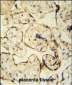 CLIC6 Antibody (Center)